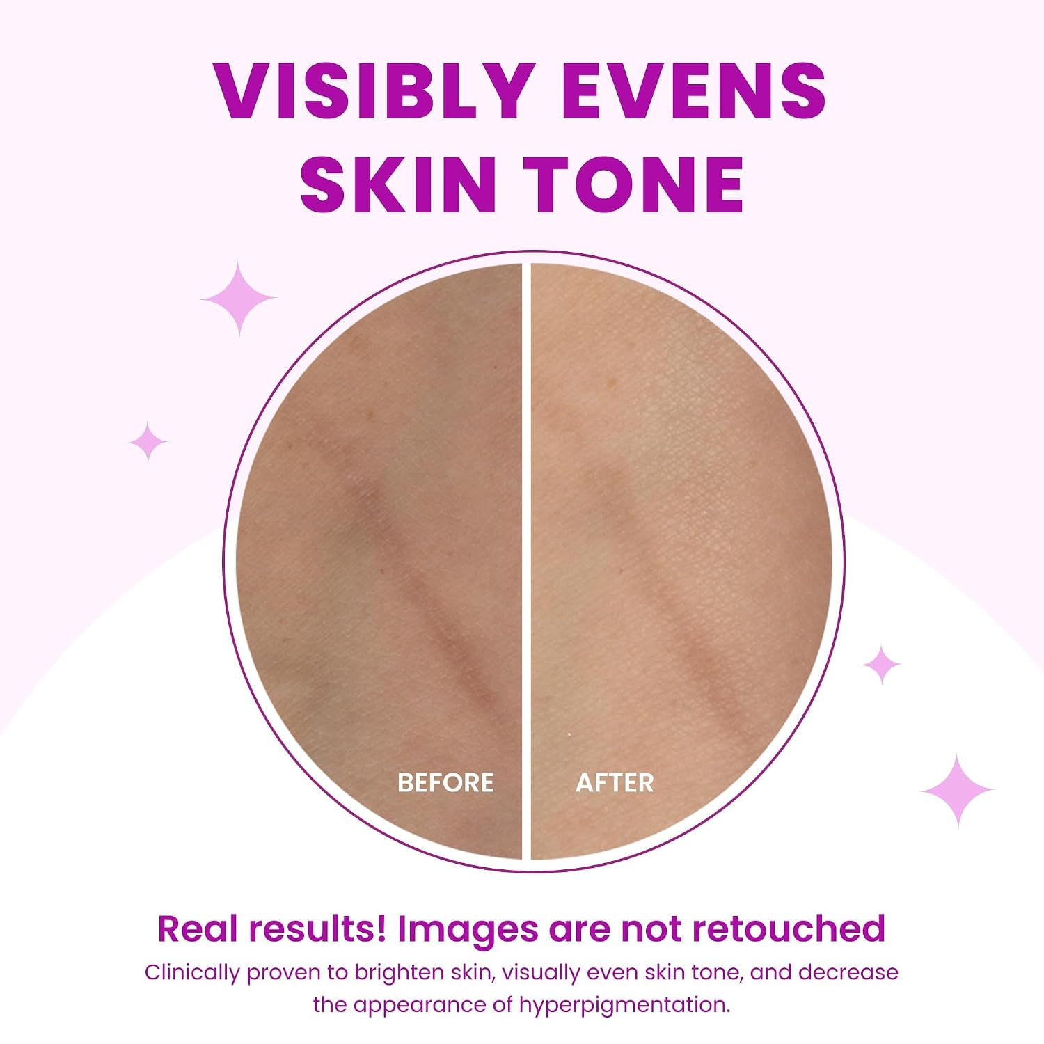 Lume Acidified Cleansing Bar